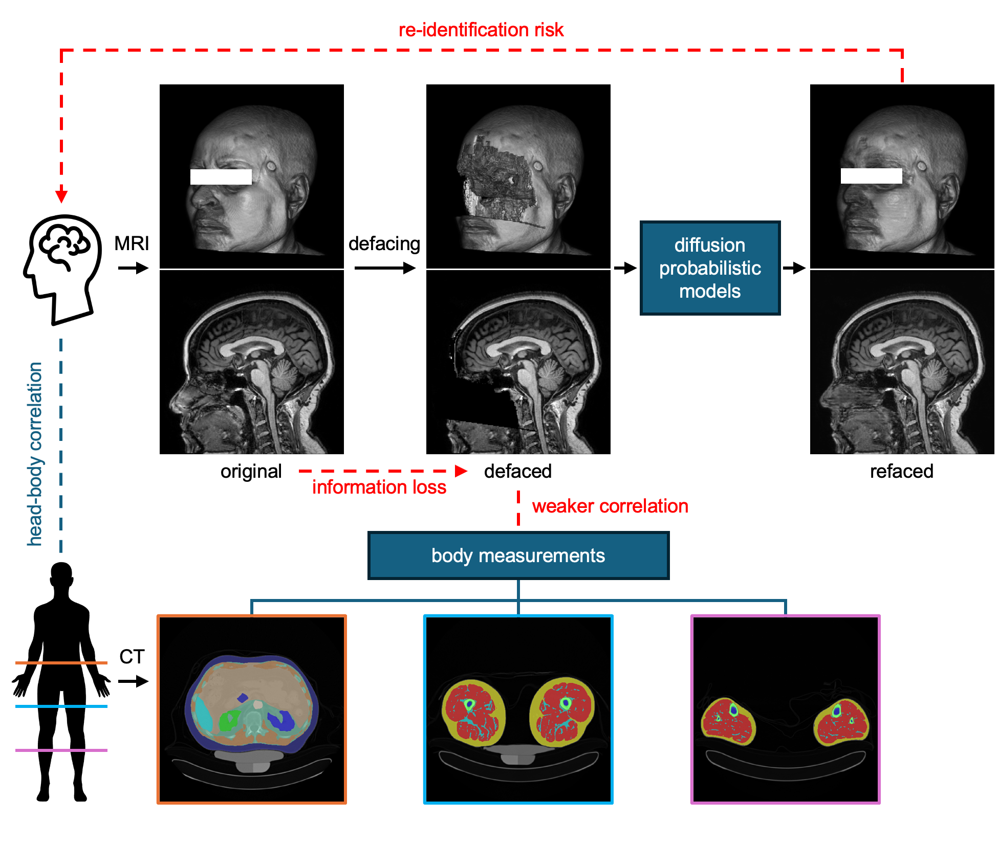 Pitfalls of defacing whole-head MRI: re-identification risk with ...